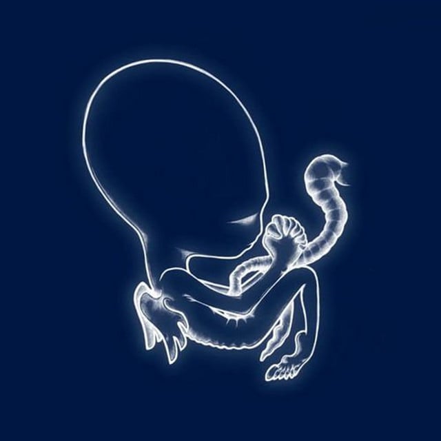 Ágætis byrjun - Album · Sigur Rós