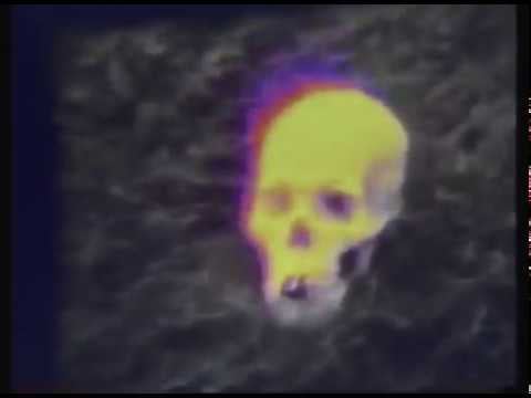 BENEATH THE SKIN (1981)