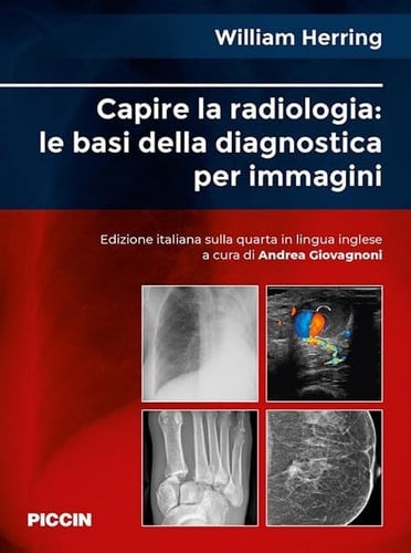Capire la radiologia: le basi della diagnostica per immagini - William Herring · 2020