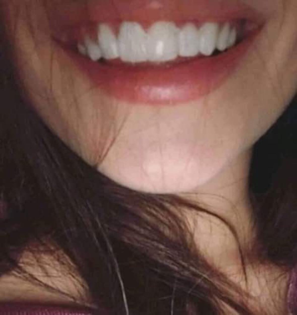 Limpieza Bucal - La higiene bucal es muy importante!!
1. trata de lavarse la boca por lo menos 2 veces al día.
2. Límpiarse los dientes con un hilo dental, los cepillitos o con un irrigador bucal antes de limpiarte los dientes con el cepillo, especialmente si tienes brackets.