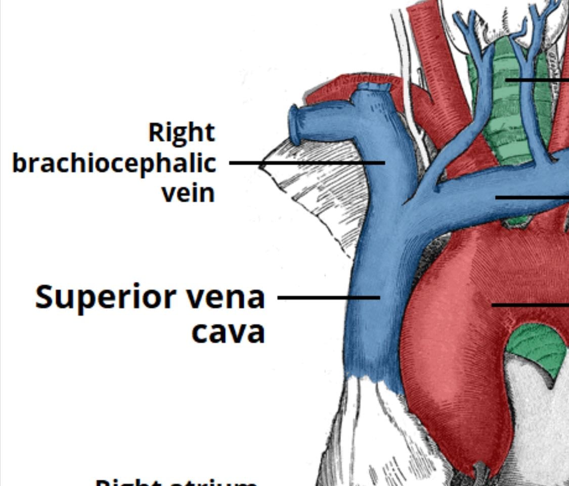 Superior vena cava - Does this need an explanation?