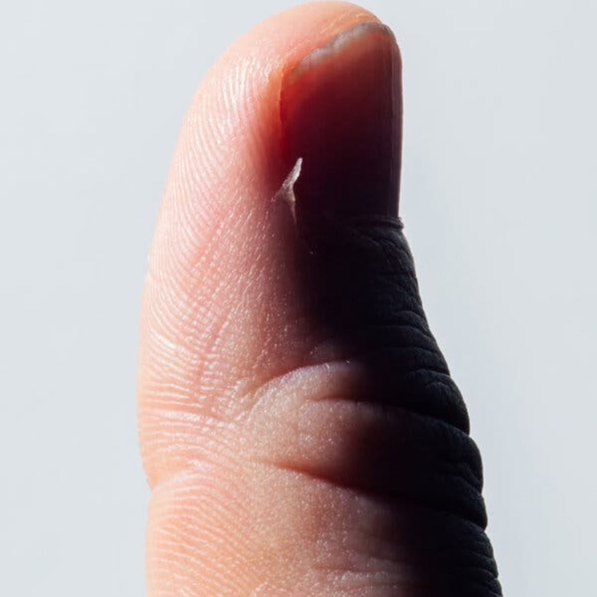 A really bad Hangnail