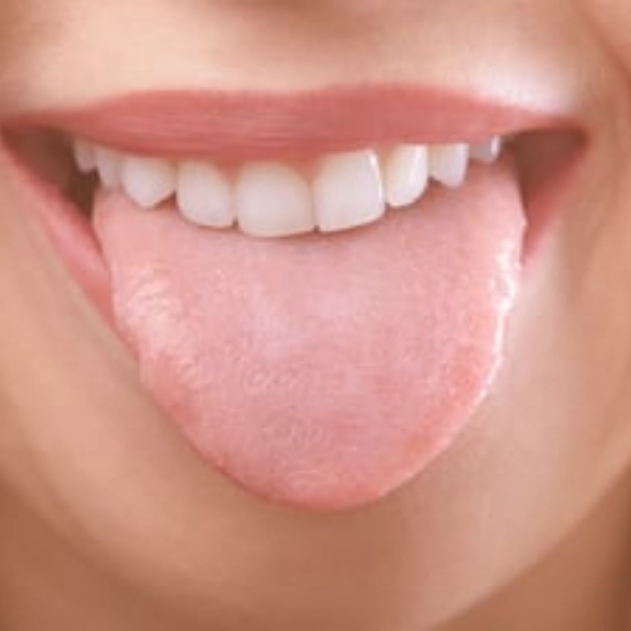 tongue