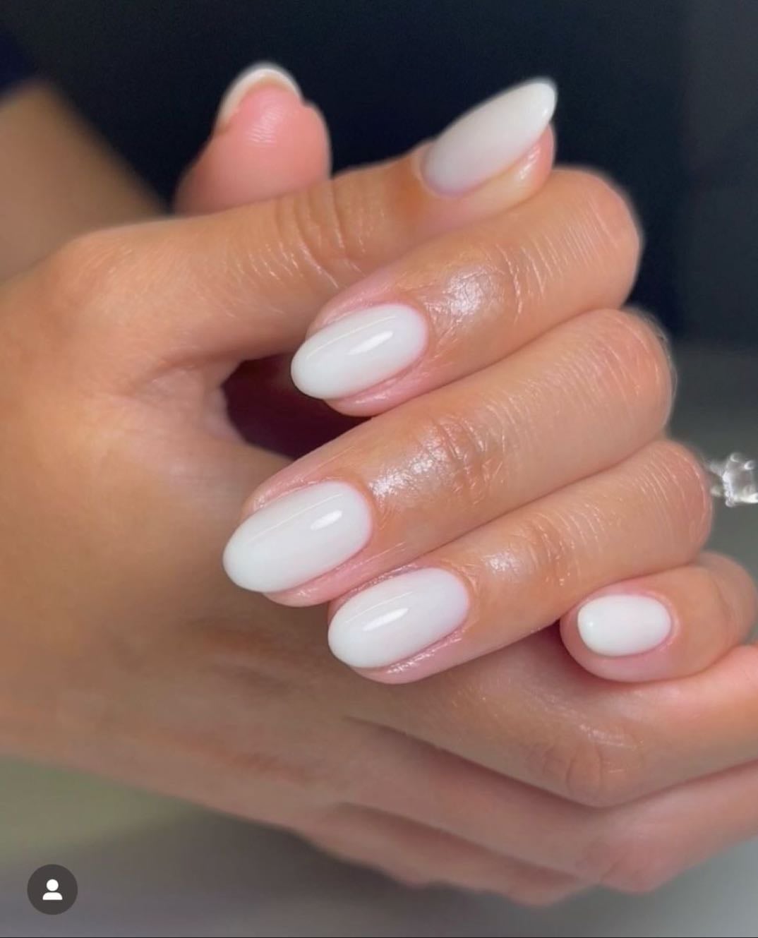 Unhas leitoso