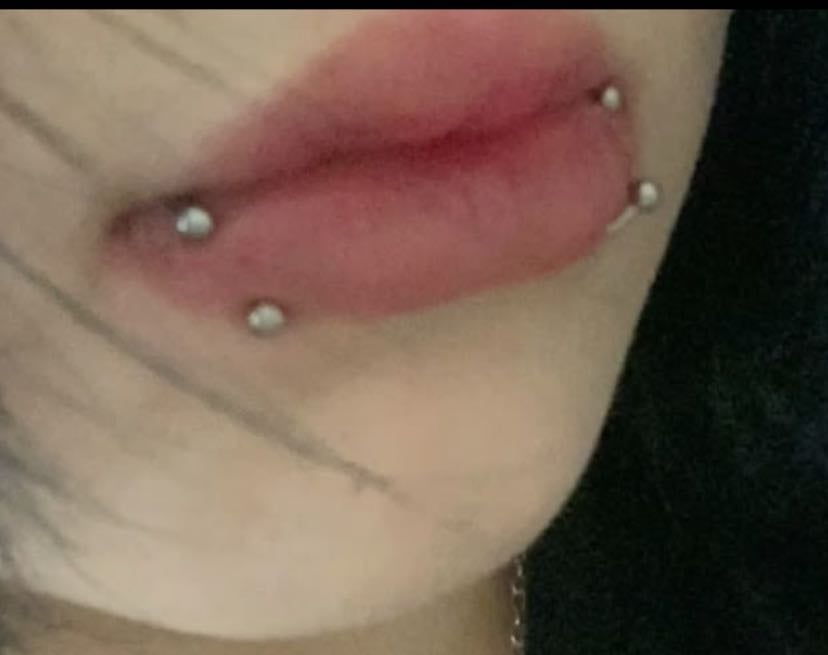 SNAKE BITES