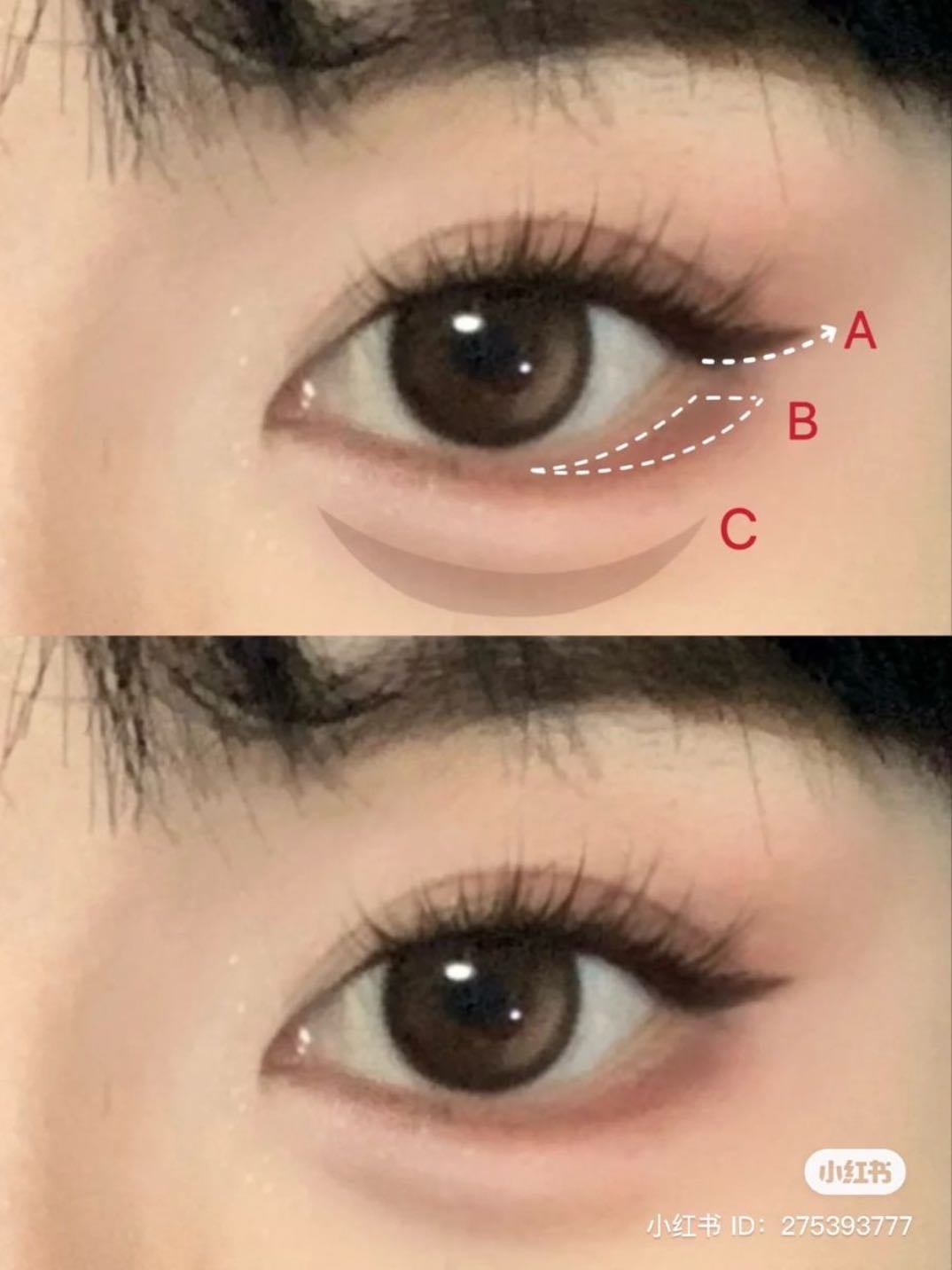 eye