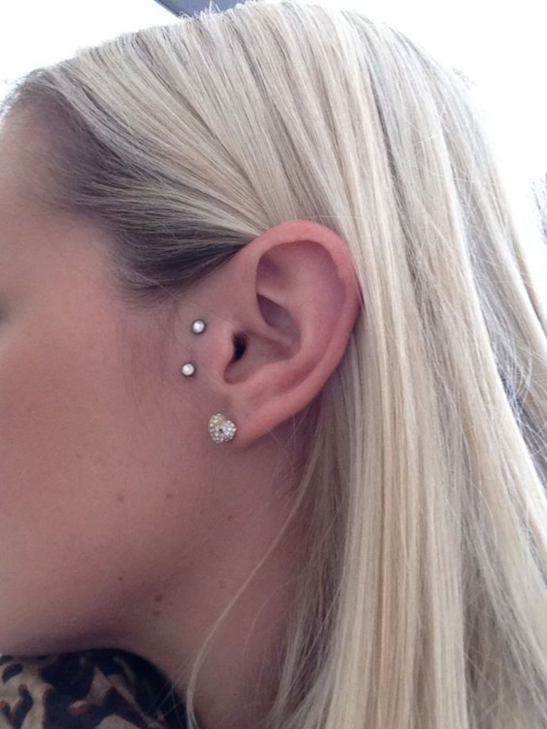 surface tragus