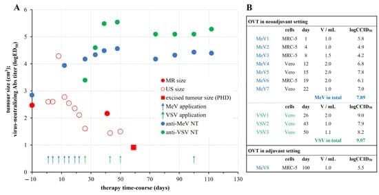 An Unconventional Case Study of Neoadjuvant Oncolytic Virotherapy for Recurrent Breast Cancer - MDPI