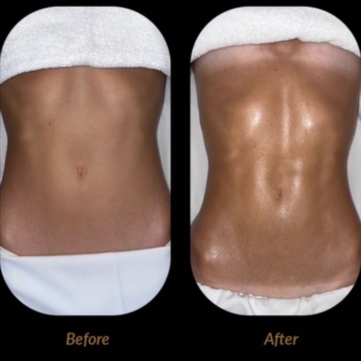 Lymphatic Massages - G entle massages that stimulate the lymphatic system can reduce water retention and swelling in the abdomen, improving overall detoxification