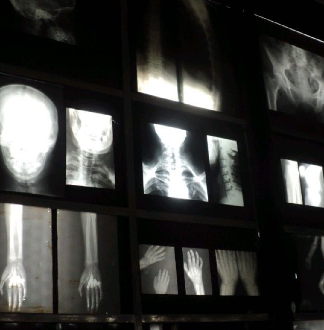 Doctor-X
