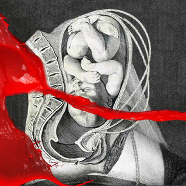 I Come With Knives - Song · IAMX