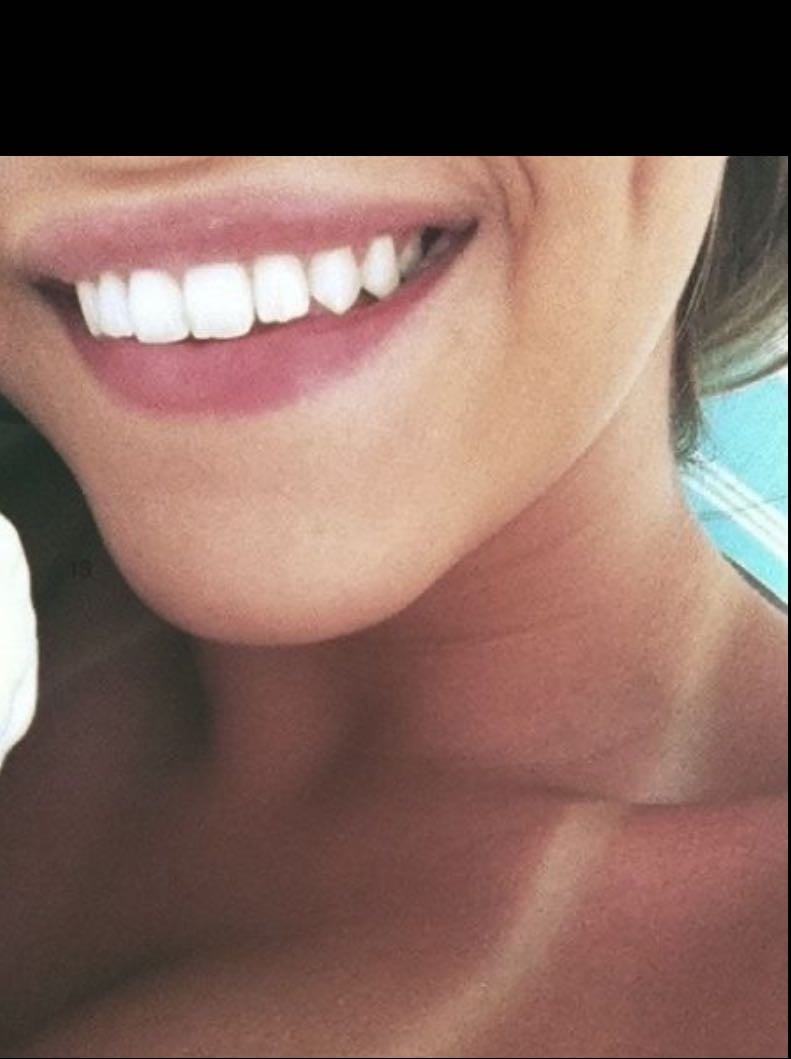 Higiene dental - Unos dientes blancos y limpios siempre van a verse mas higiénicos y bonitos
-Cepillarse durante 2 minutos a la mañana y antes de dormir
-Cepillarse suavemente la lengua para eliminar el mal aliento
-Usar hilo dental
-Enjuague bucal
