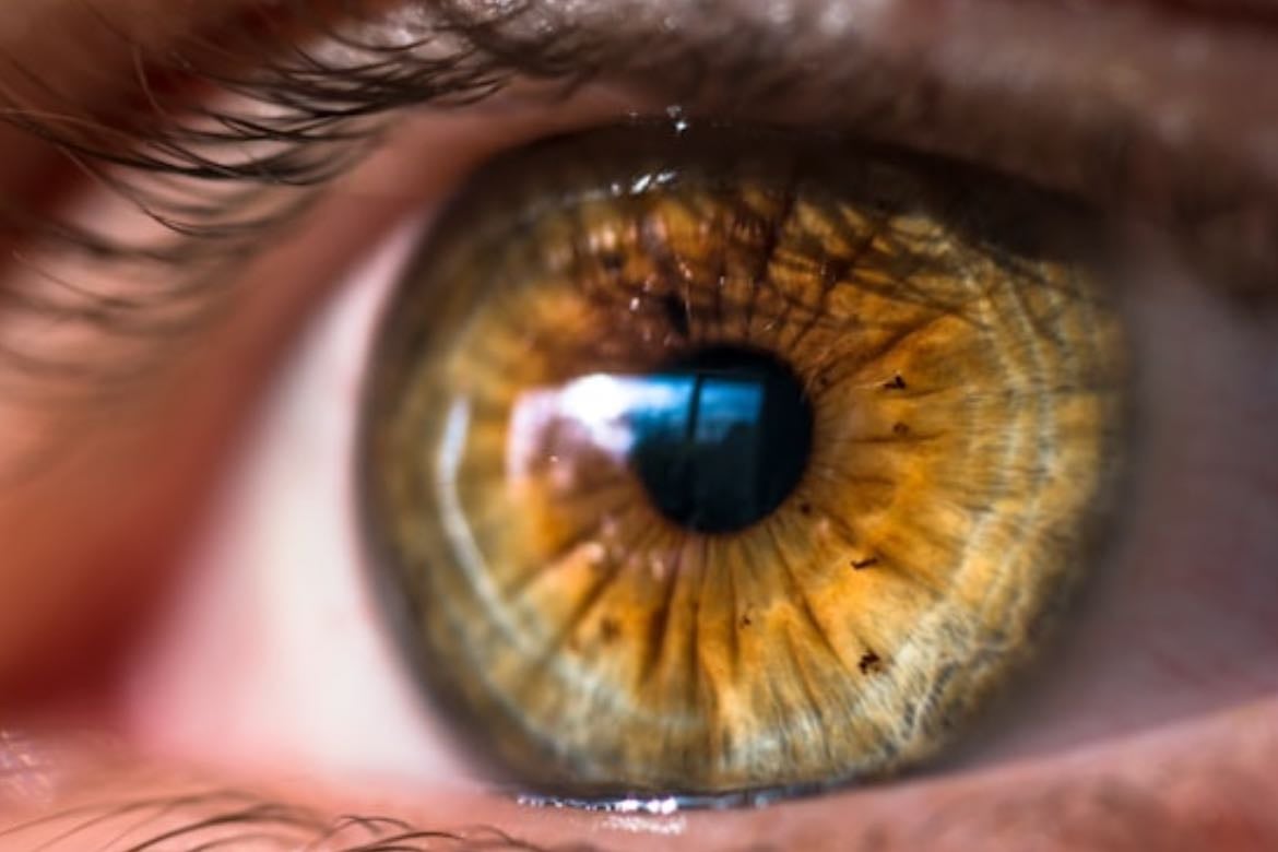 eyes