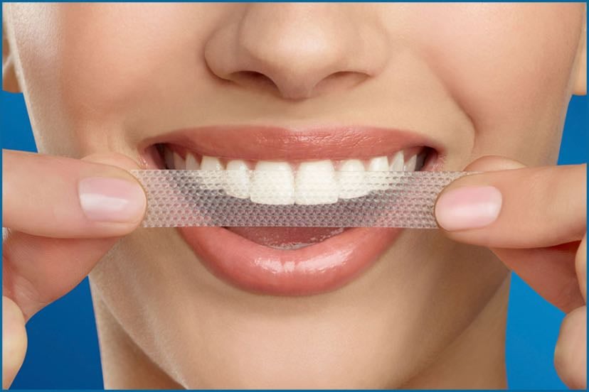 Whiten your Teeth