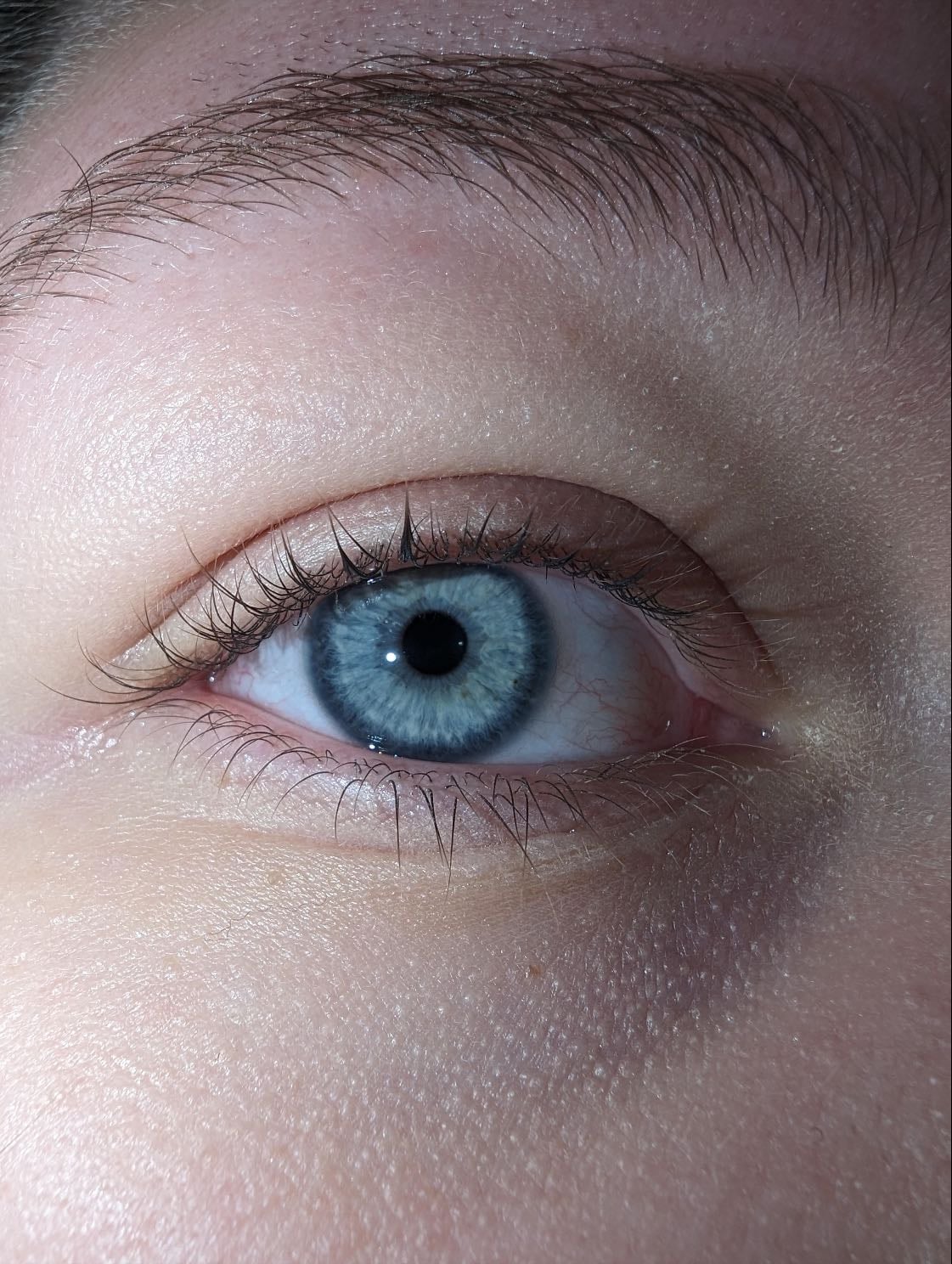 blue eyes