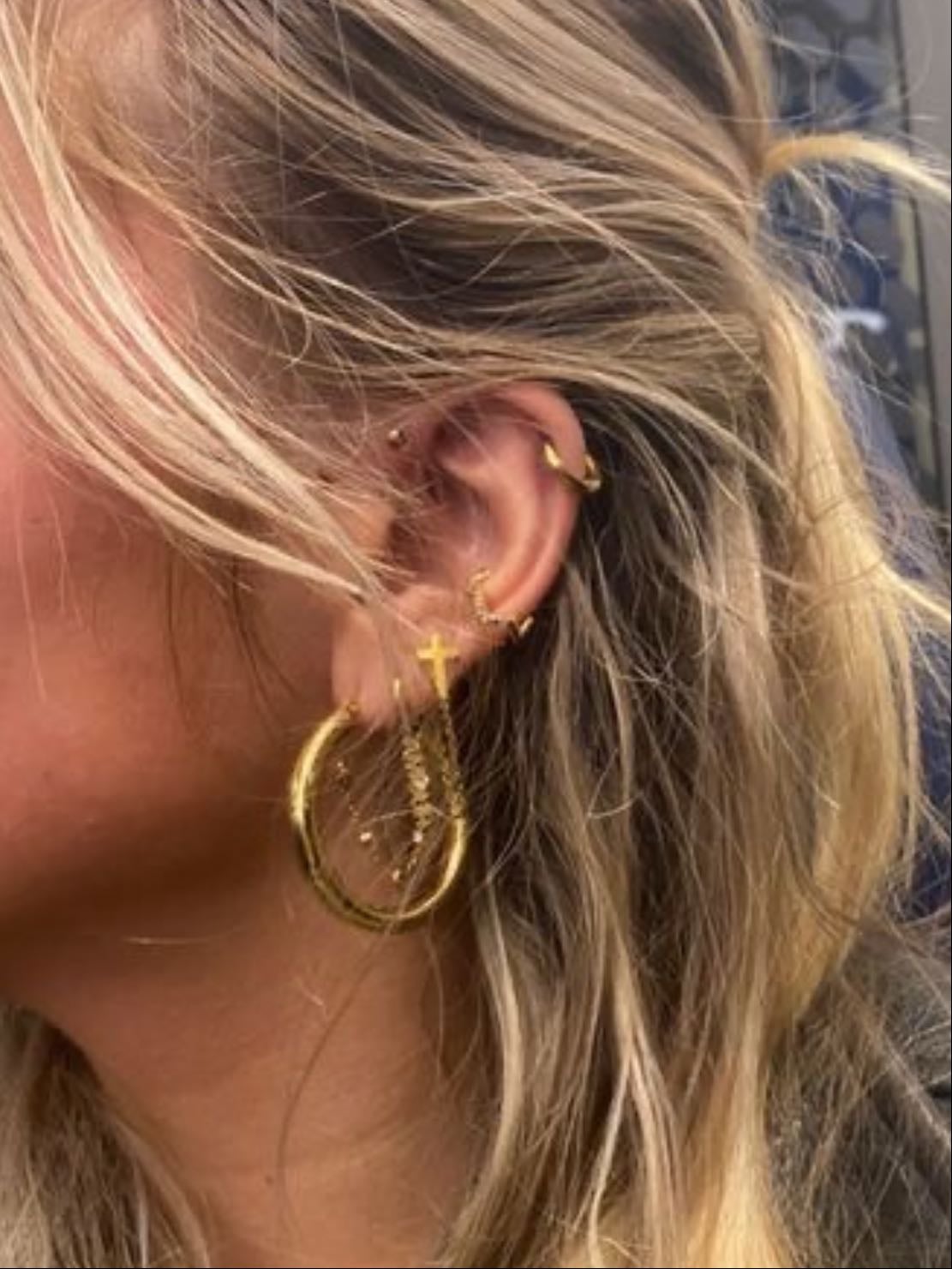 cartilage hoop