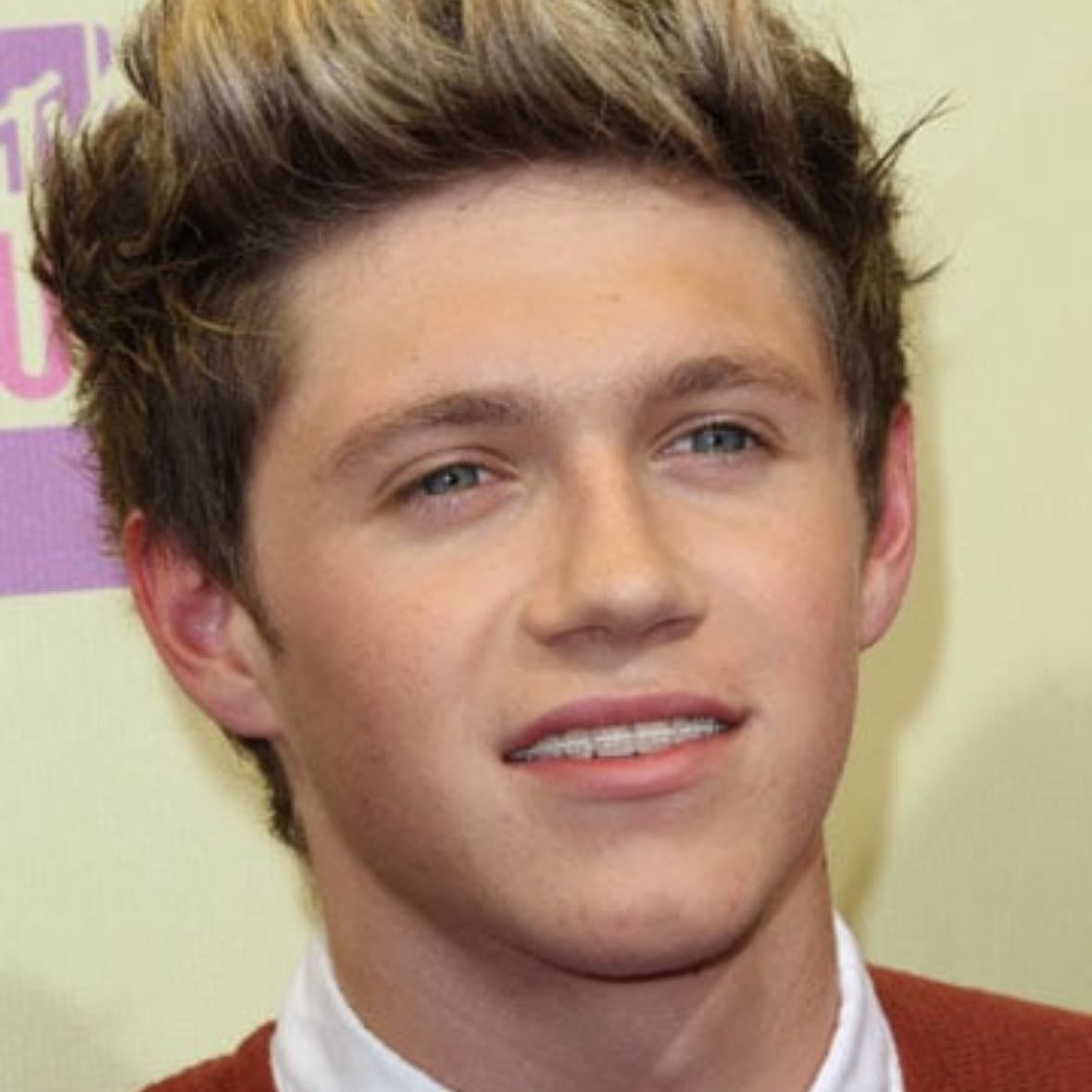 1. Braces Niall - the literal cutest guy ever! Hes so adorable i cant even