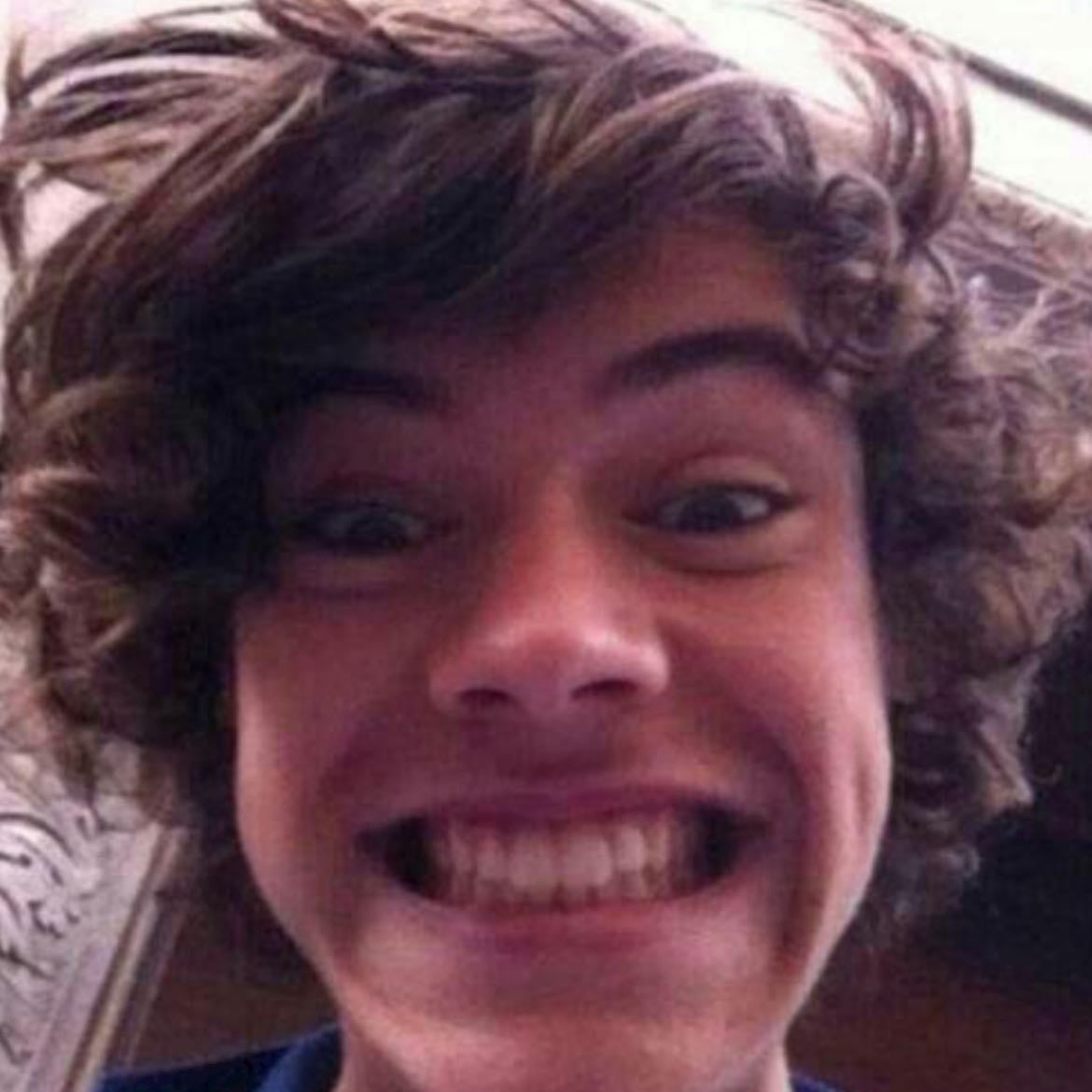 Fetus Harry