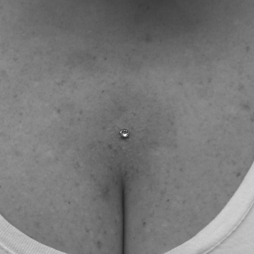 chest dermal