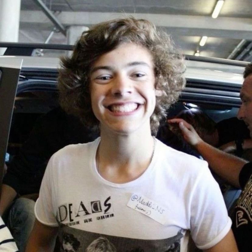 fetus harry #2 - look at that smileš„¹ heās so cute awh