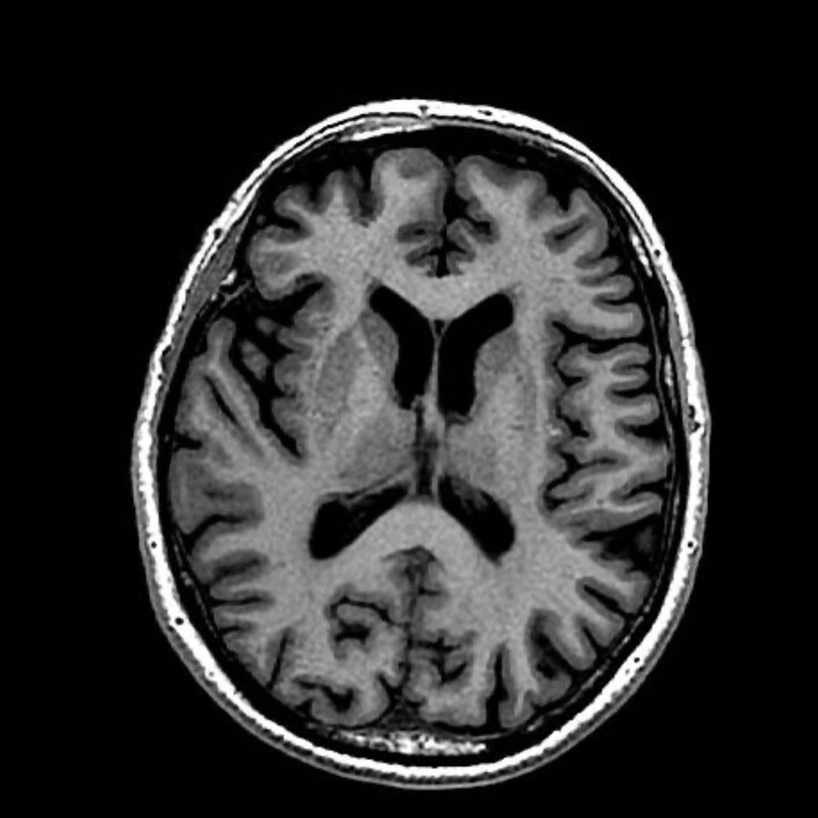 Every part of the brain - Where they are, their name and what they do.