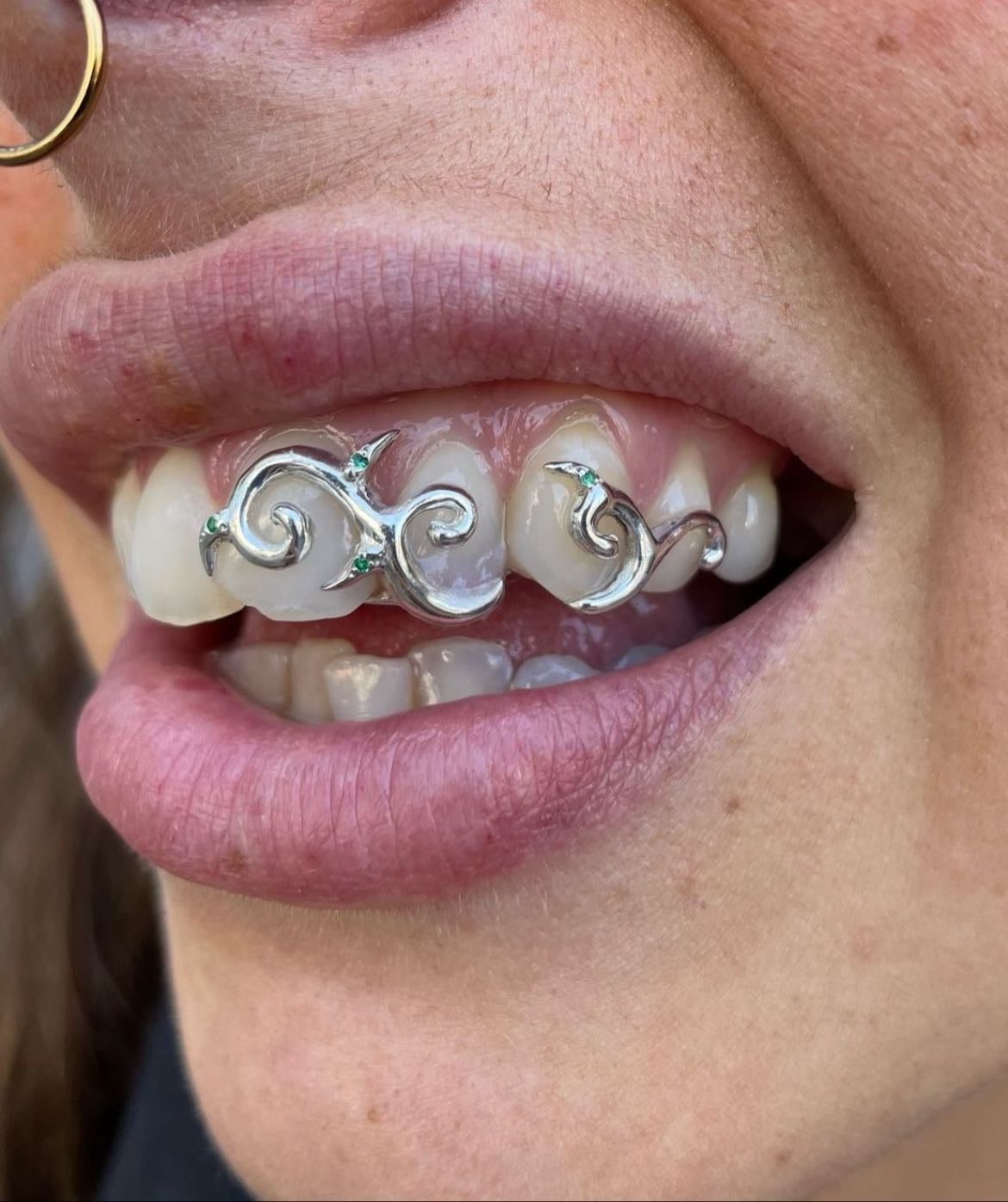 custom grillz