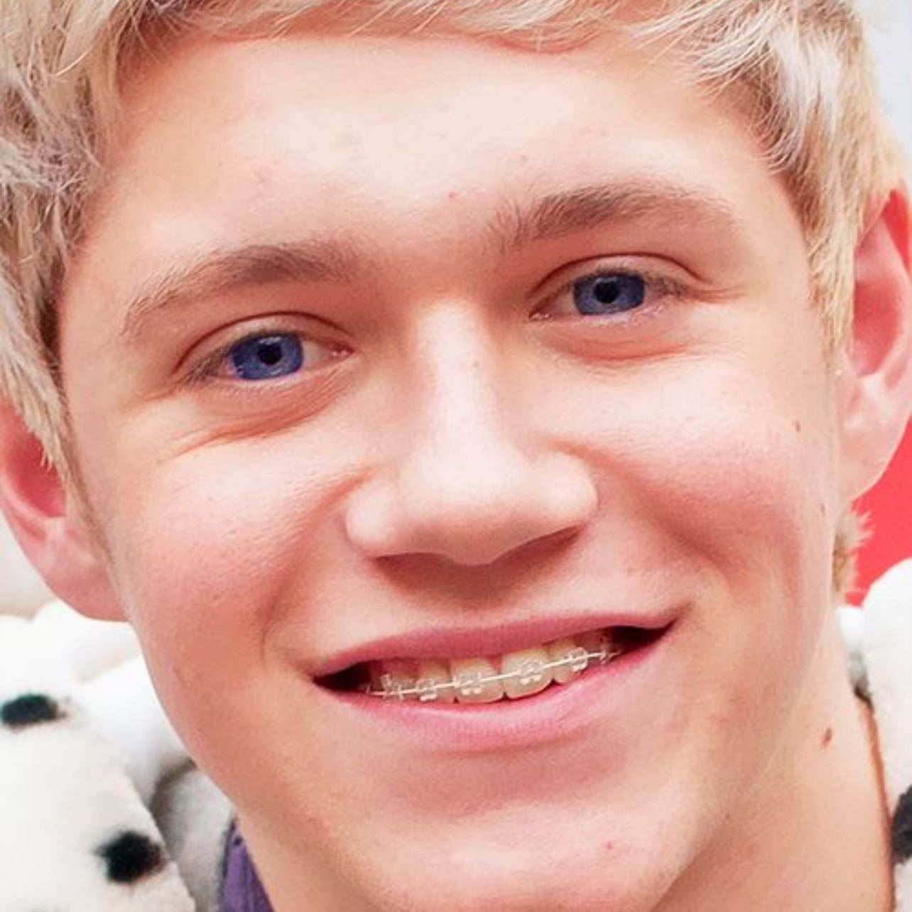 braces niall