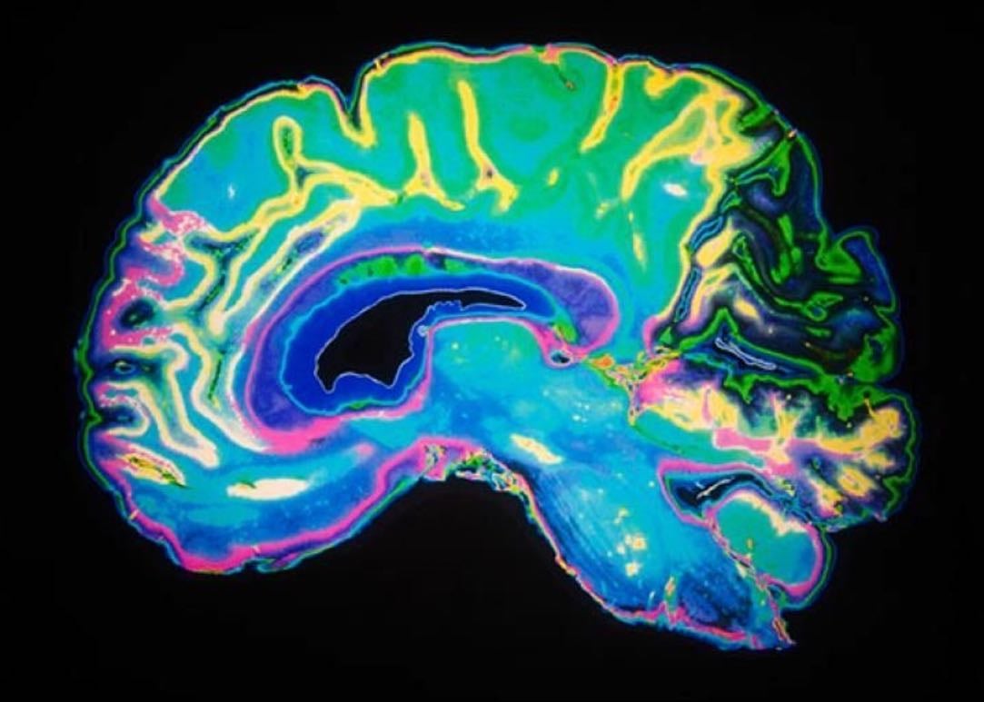 Dopamine