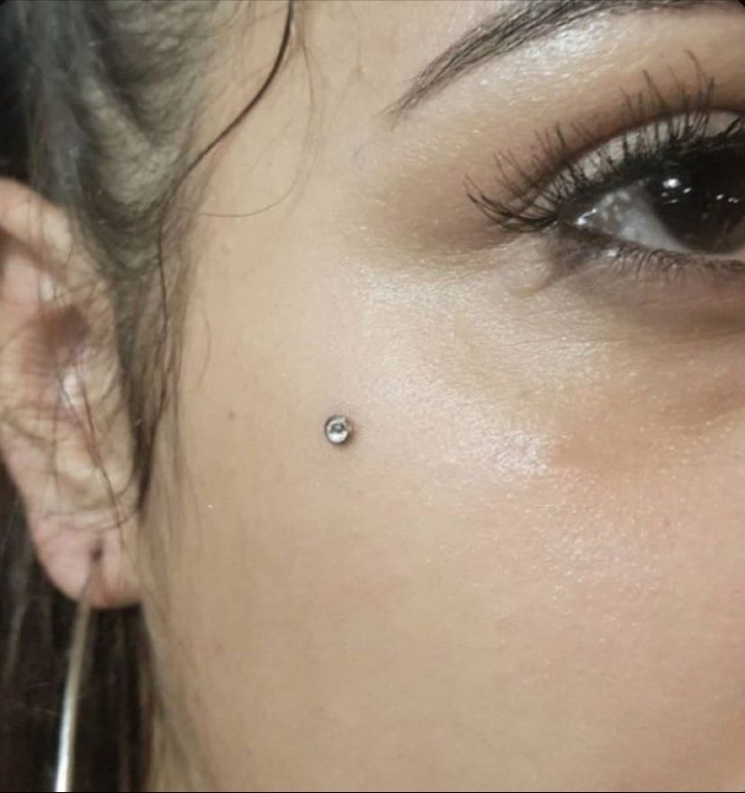 cheek dermal/s