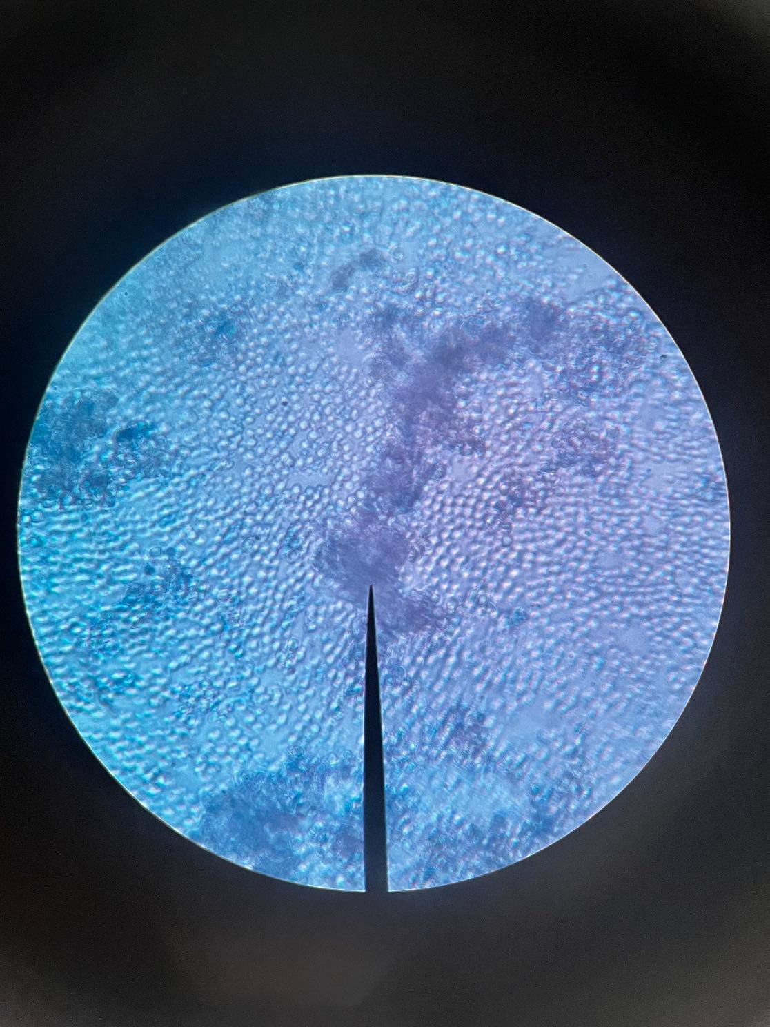 Levadura - +azul dimetileno +microoscopio
