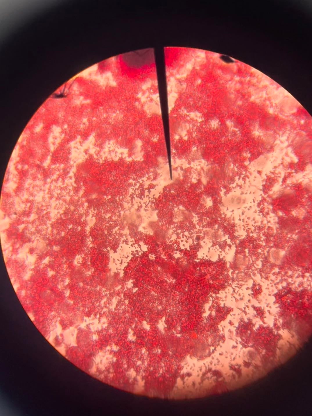 Prueba coprológica + tinsión de gram - Gram -