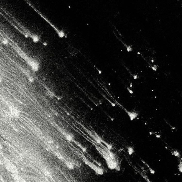 Ver las estrellas mientras tenemos deep conv y escuchamos música