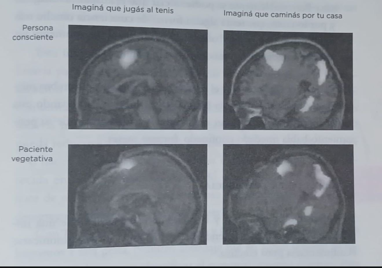 OBSERVANDO LA IMAGINACIÓN: paciente en estado vegetativo
