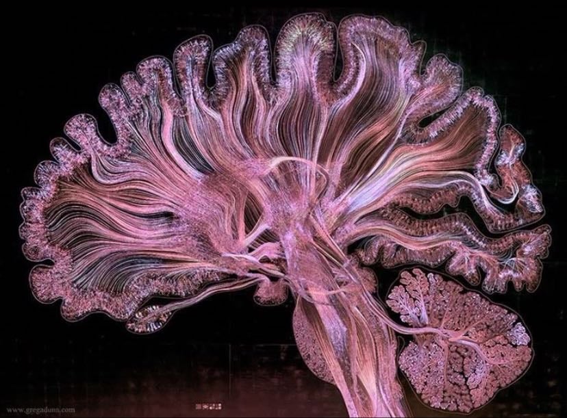 Cerebro humano