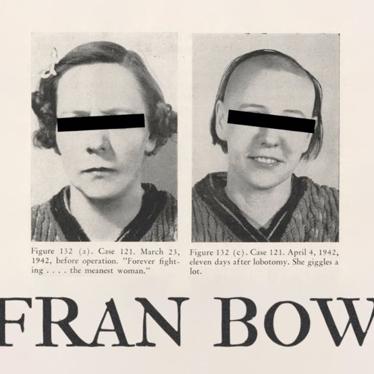 FRAN BOW is about LOBOTOMY - Uri Clarke