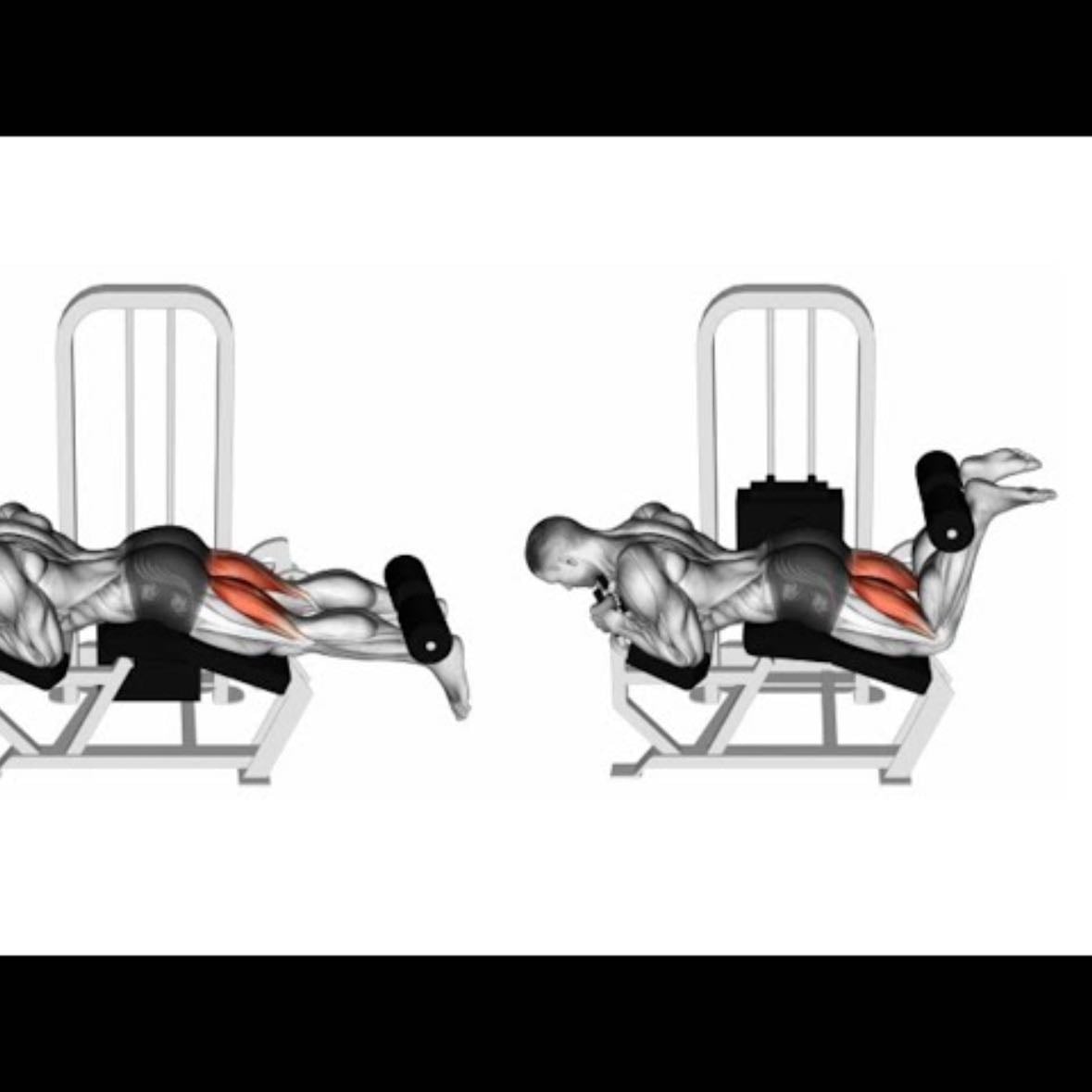 Femoral tumbado