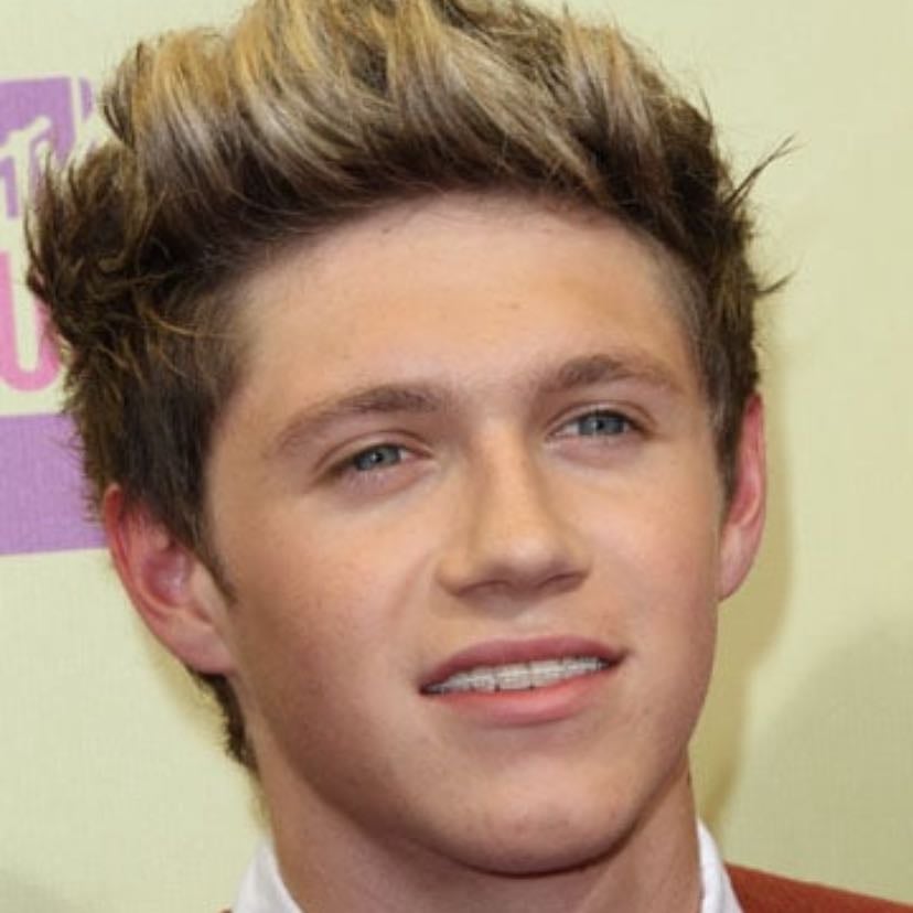 BRACES NIALL. - SOSOSOSOSOSOOSOOOO CUTE