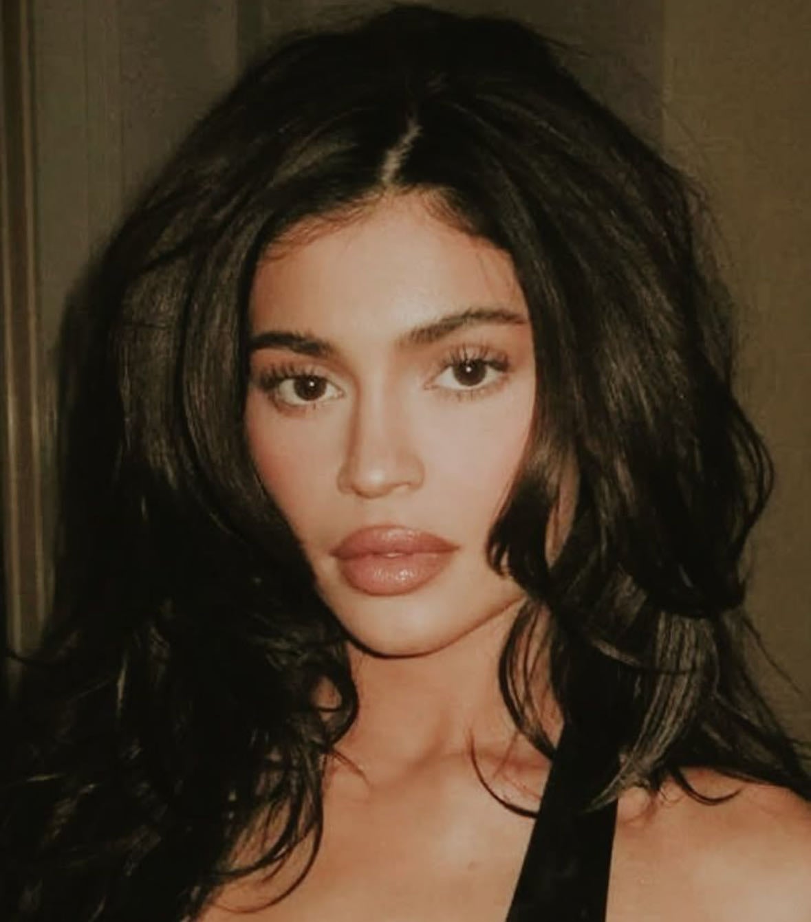 goodbye fillers, hello… facelifts? - Mina Le