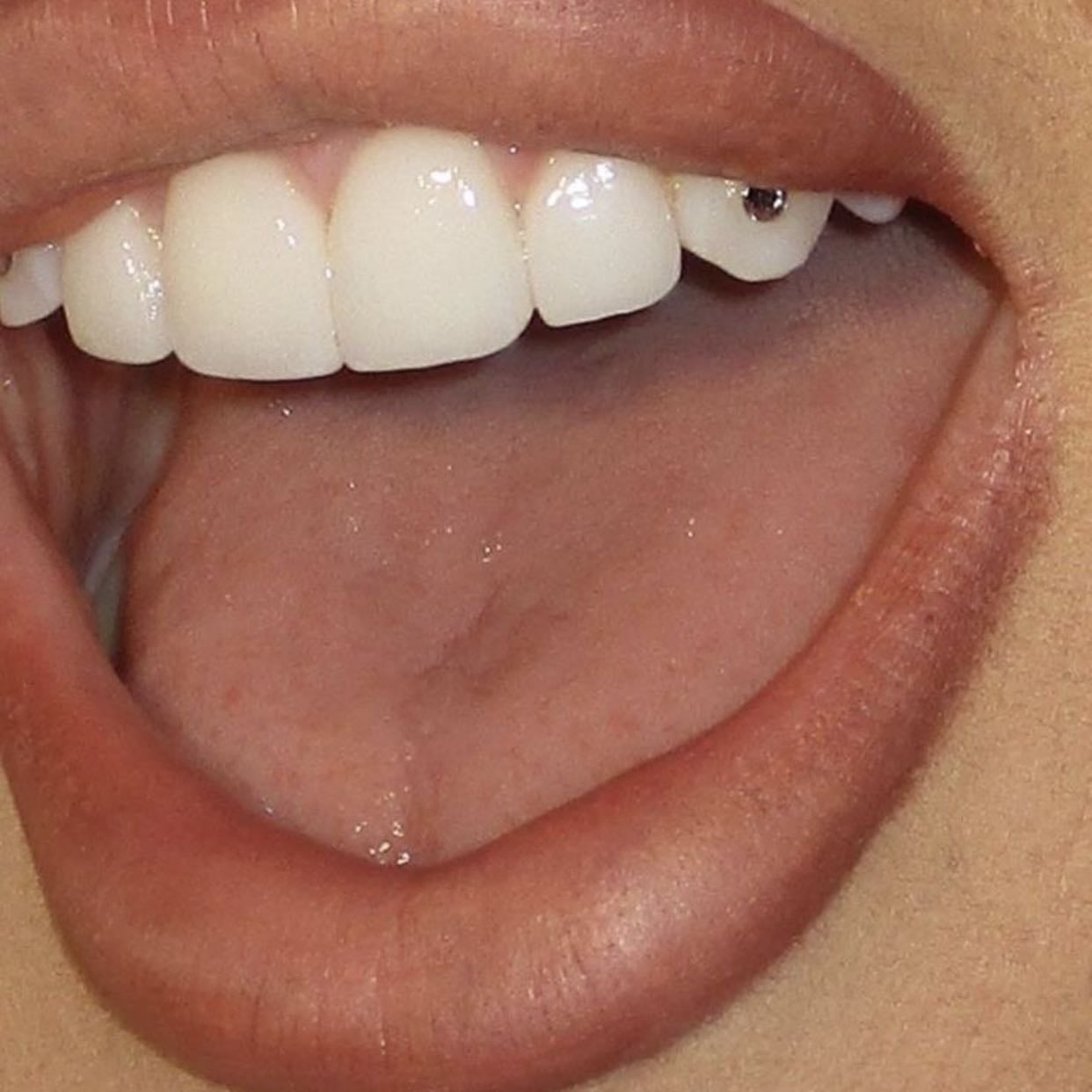 Dientes - Cuidar mi dientes