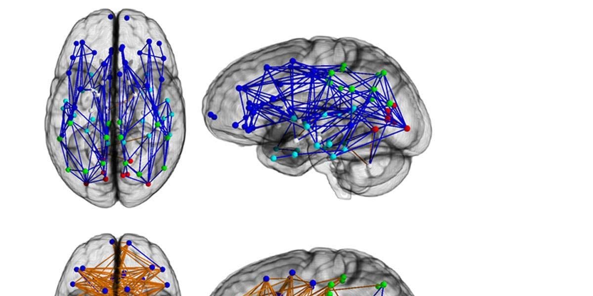 DIFERENCIAS NEUROBIOLÓGICAS DE CEREBROS DE MUJERES Y HOMBRES - Tu yo de 1400 gramos