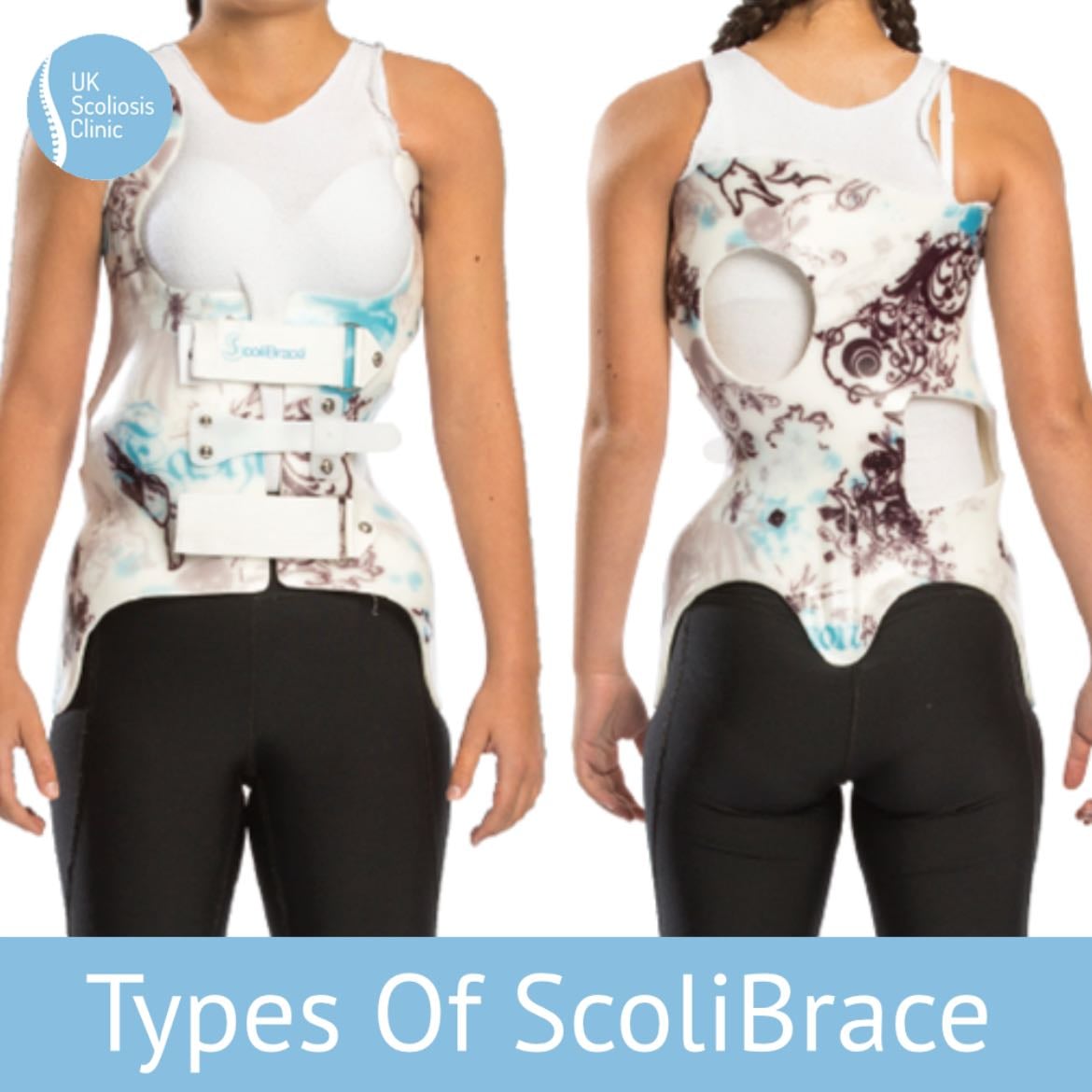 Brace - Straightness