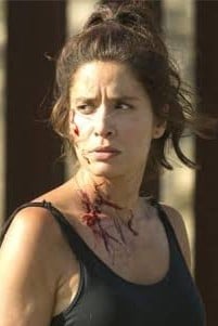 Ofelia Salazar - infeccion, mordida