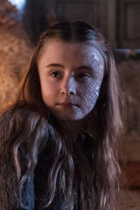 Shireen Baratheon - quemada por orden de su padre