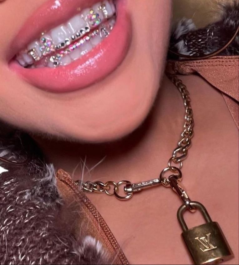 Teeth gems