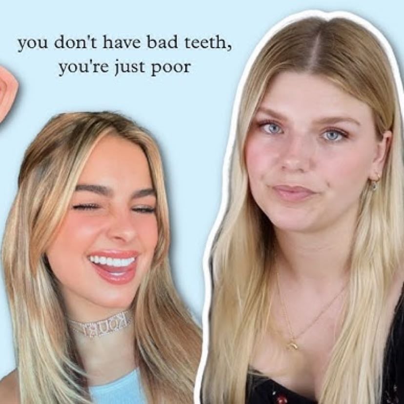 good teeth are a luxury on the rich can afford | Internet Analysis - tiffanyferg