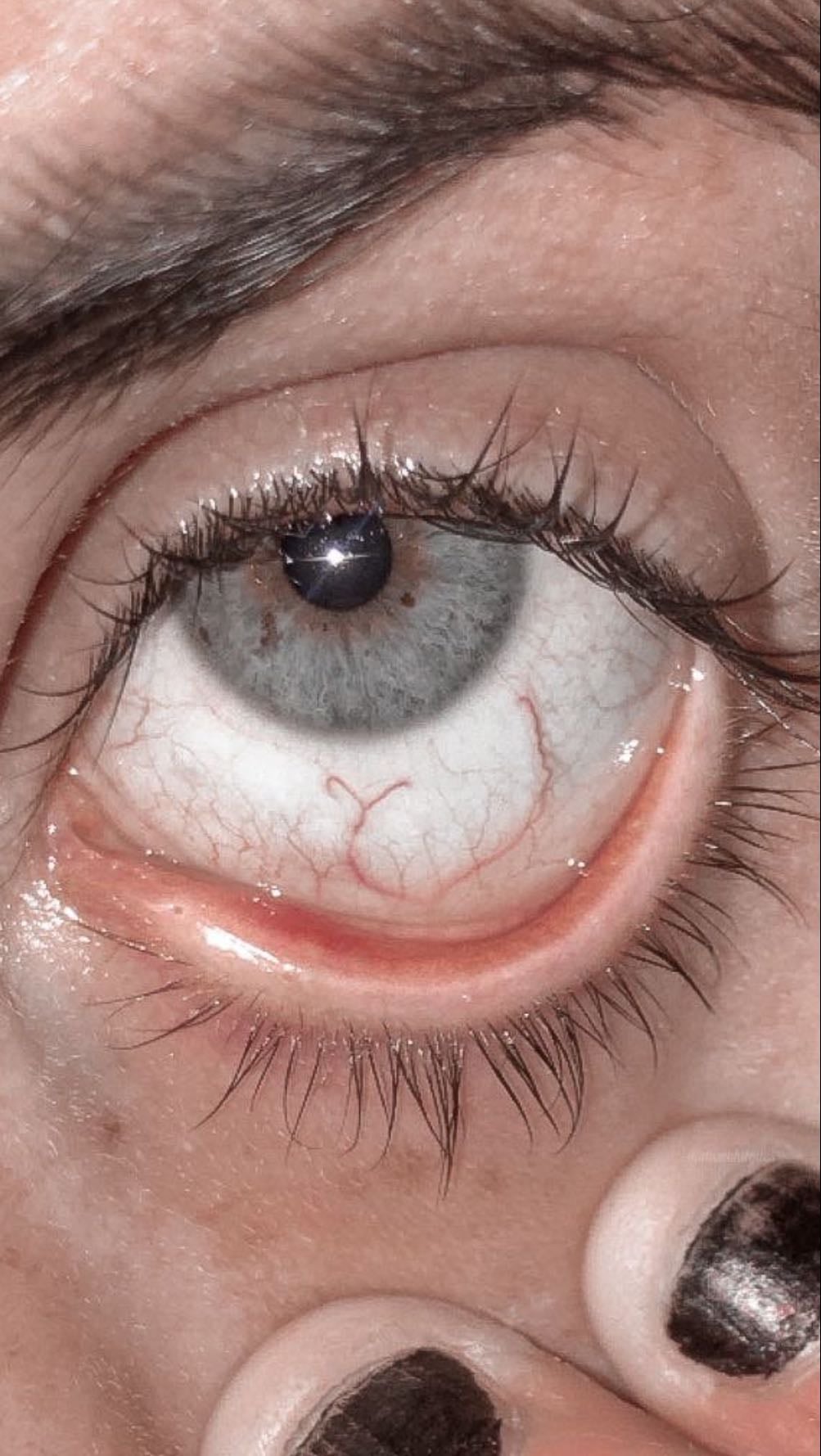 Pulled eyes