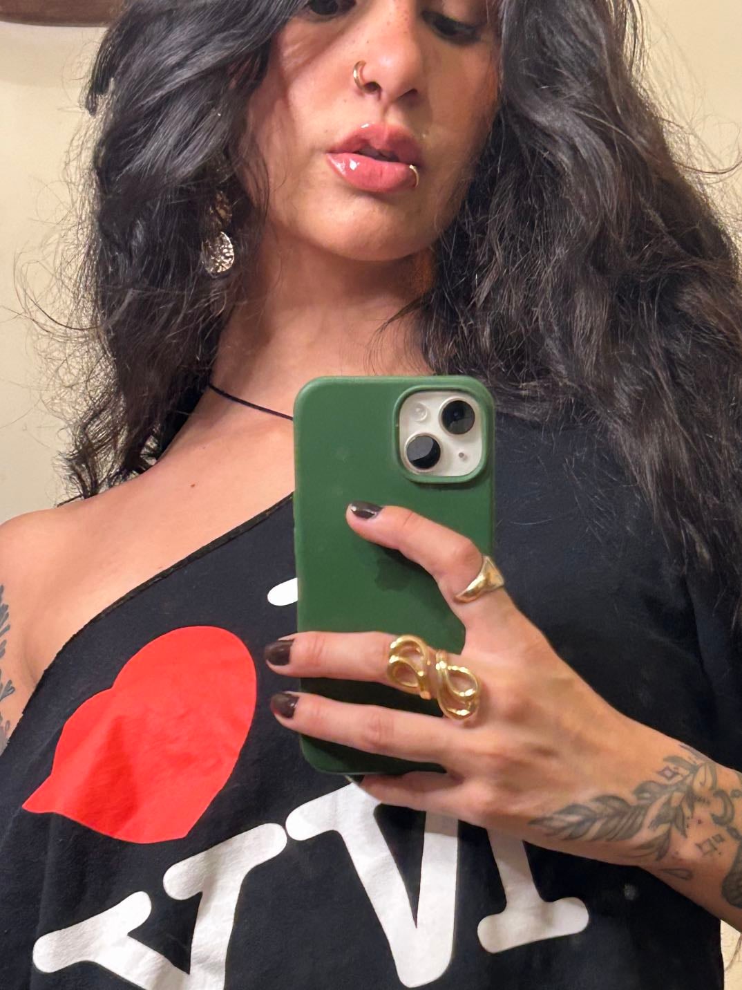 lip filler (dra fernanda)