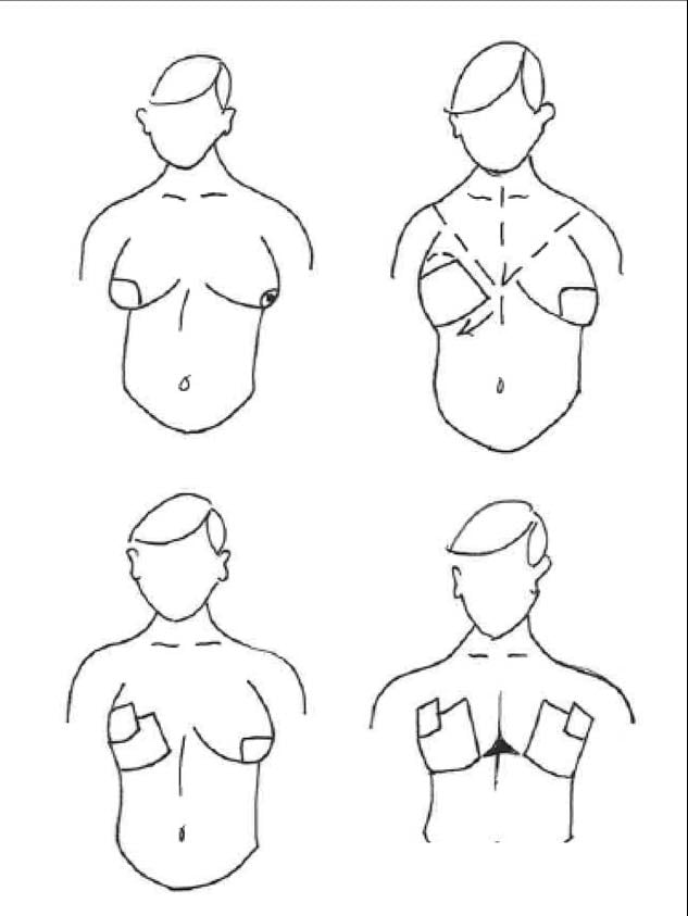 trans tape