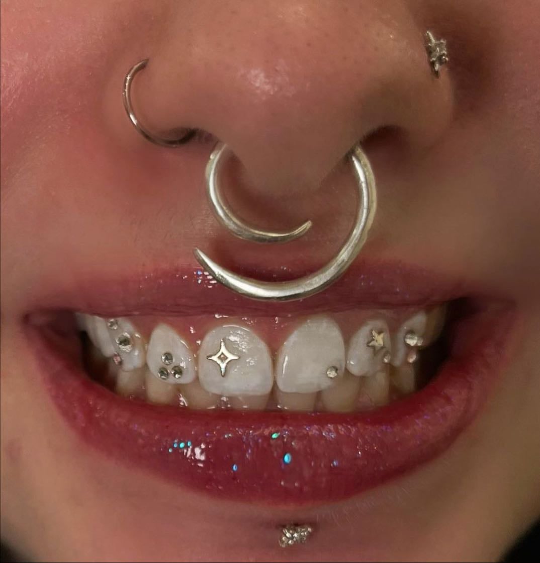 get tooth gems