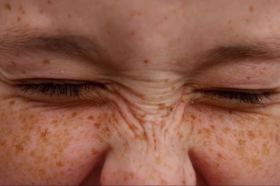 my freckles - my whole personnality